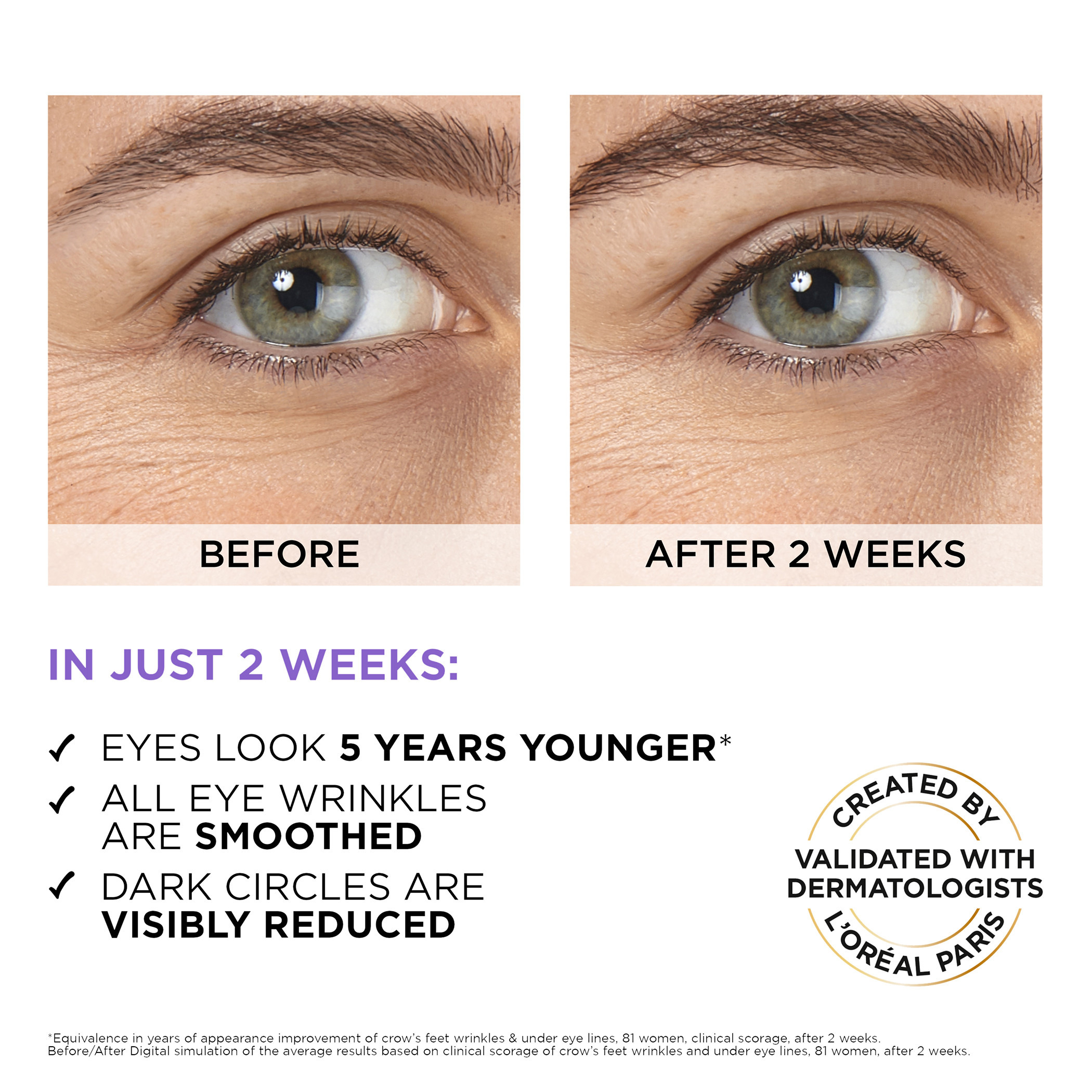 L'oreal Paris Hyaluron Expert Eye Serum - 20 ml-beautyandpersonalcare-skin-eyecare-image-6