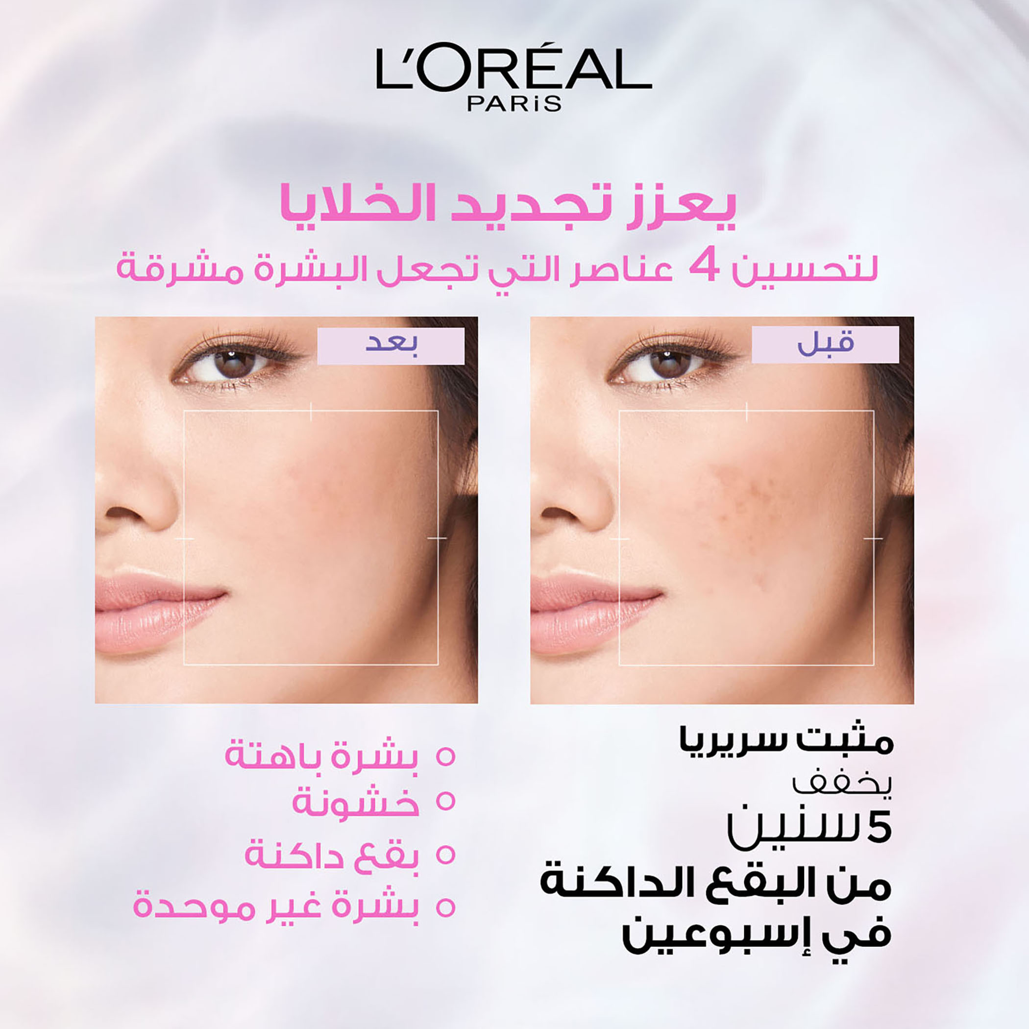 L'Oreal Paris Glycolic Bright Serum - 15 ml-beautyandpersonalcare-skin-treatmentsandserums-image-2