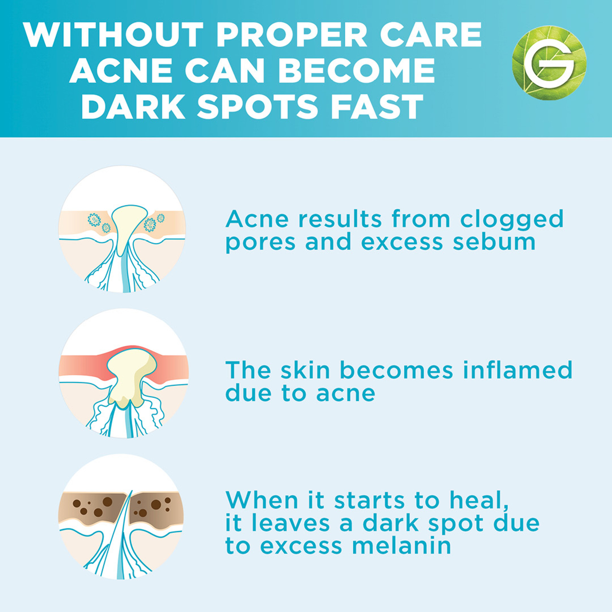 Garnier Skinactive Fast Clear Anti Acne Booster Serum - 30 ml-beautyandpersonalcare-skin-treatmentsandserums-image-11