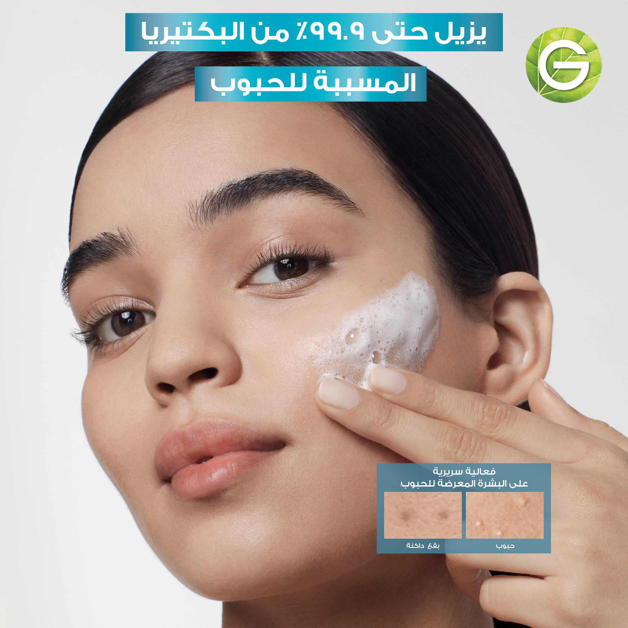 Garnier Skinactive Fast Clear 3-in-1 Face Wash - 150 ml-beautyandpersonalcare-skin-treatmentsandserums-image-5