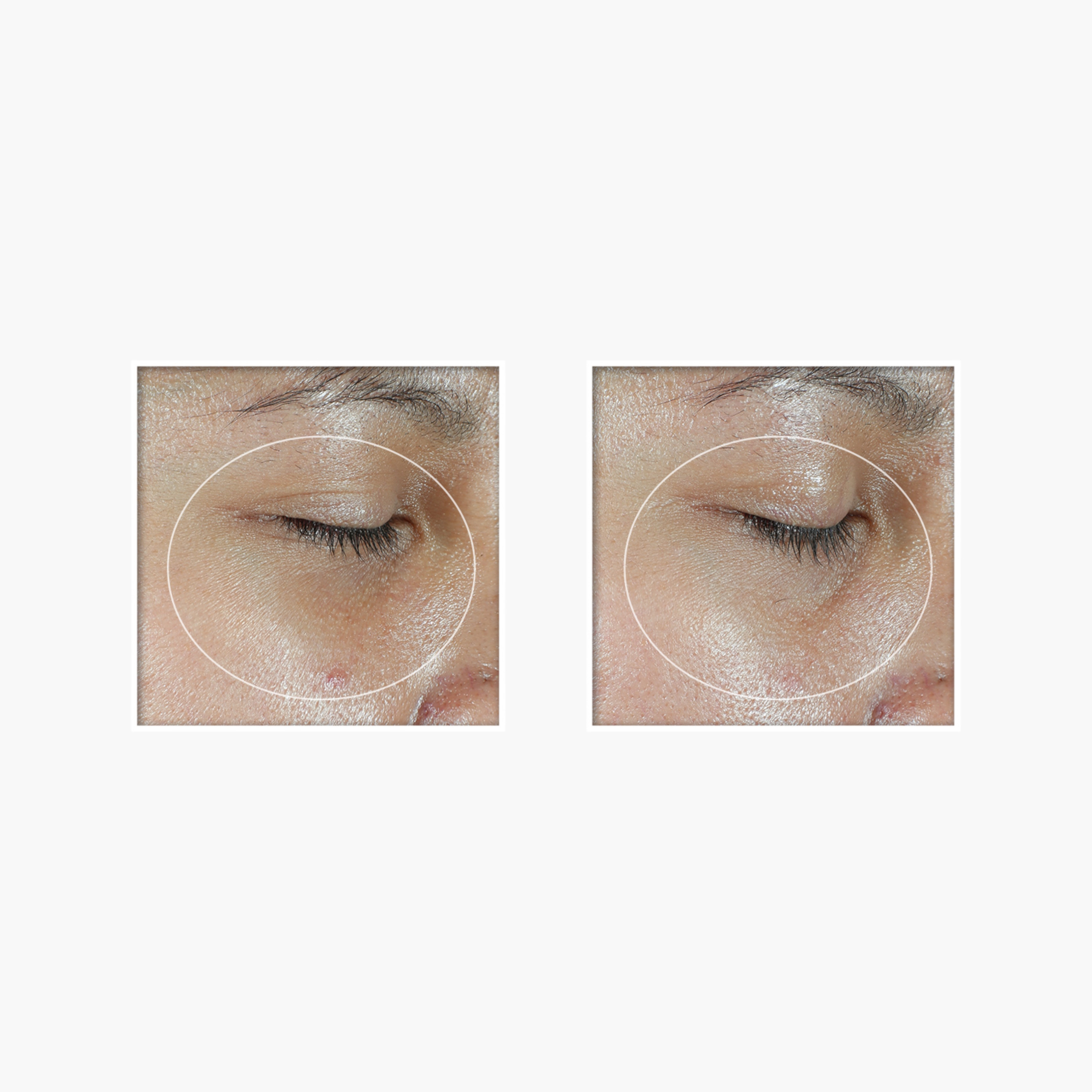 ROC Multi Correxion Revive and Glow Eye Stick - 4 gms-beautyandpersonalcare-skin-eyecare-image-4