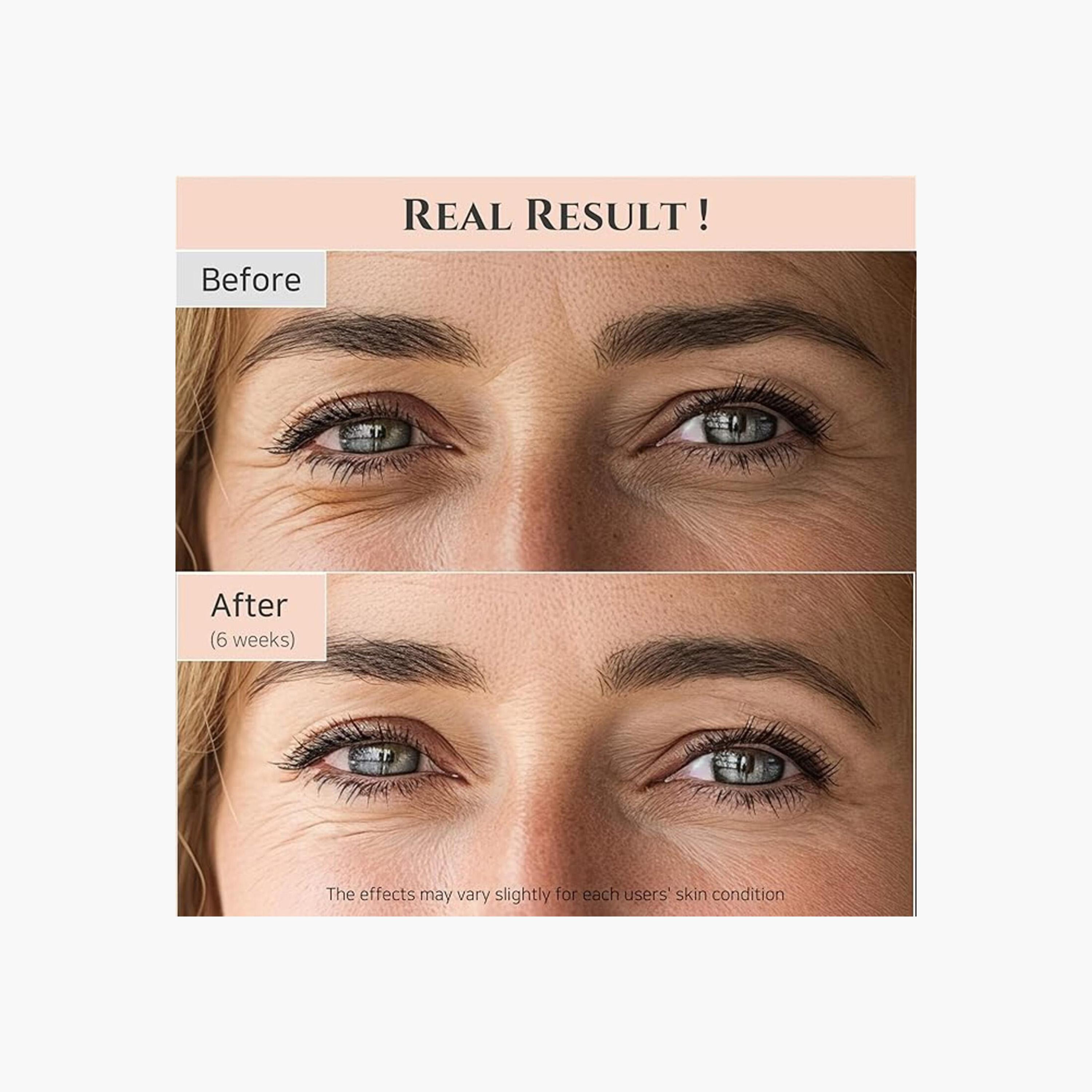 Beauty of Joseon Ginseng + Retinal Revive Eye Serum - 30 ml-beautyandpersonalcare-skin-eyecare-image-5