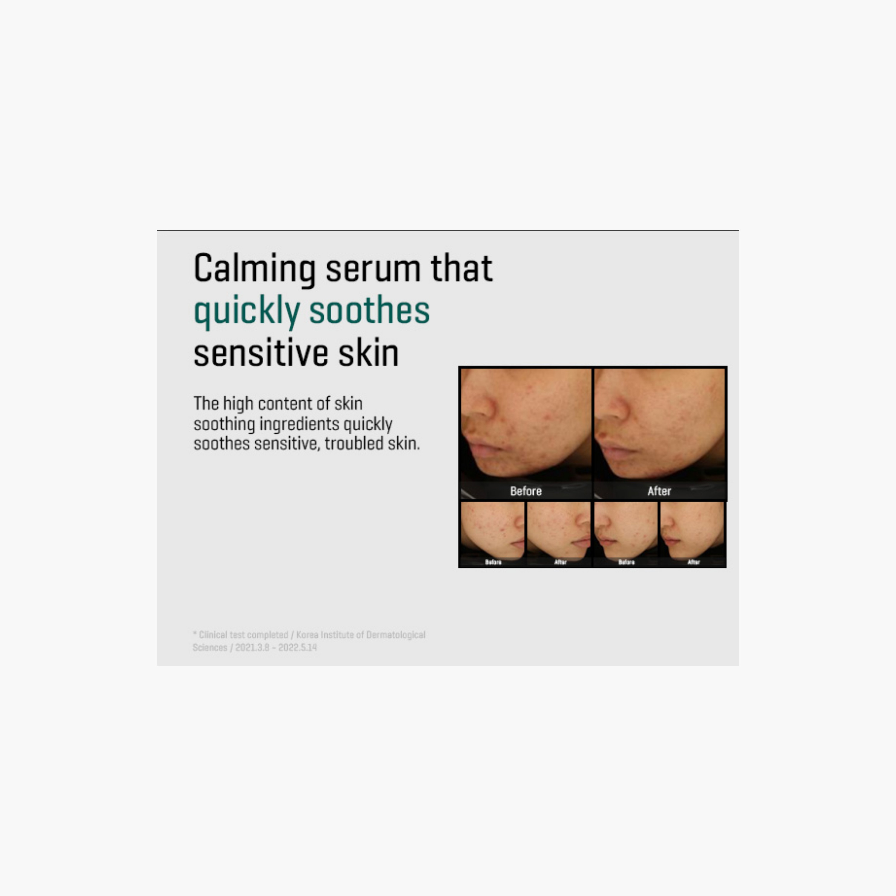 سوم باي مي سيروم ميراكل لايت 50 مل-beautyandpersonalcare-skin-treatmentsandserums-image-4