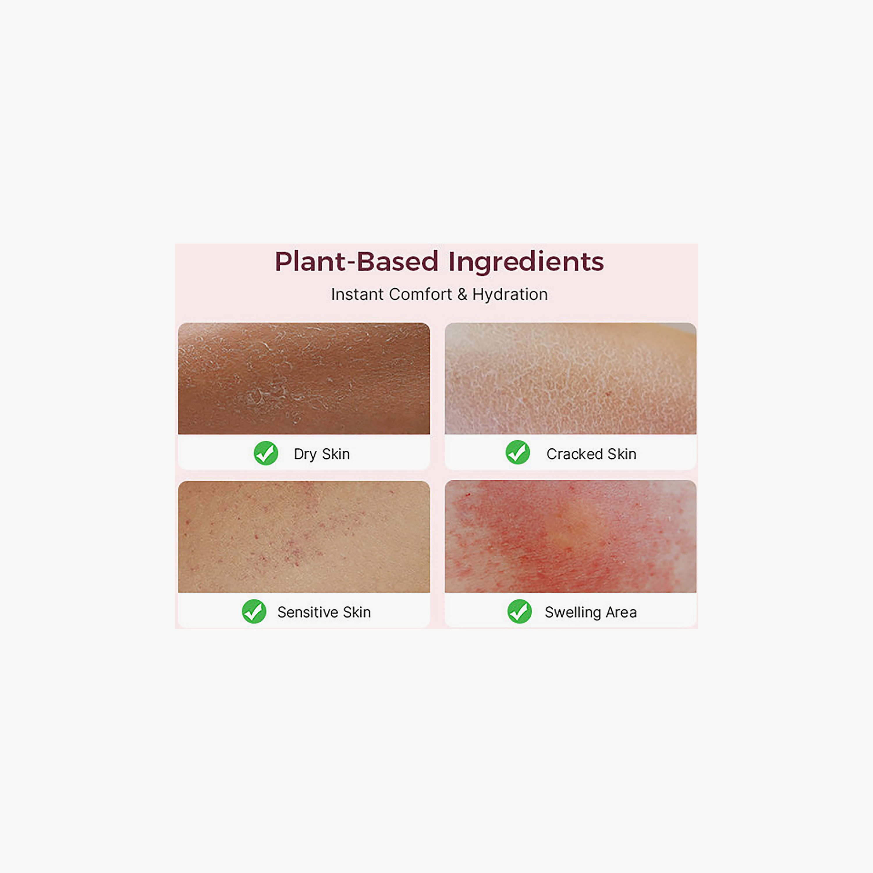 Momcozy ComfortNip Nipple Cream - 50 gm-beautyandpersonalcare-babycare-lotionsandcreams-image-2