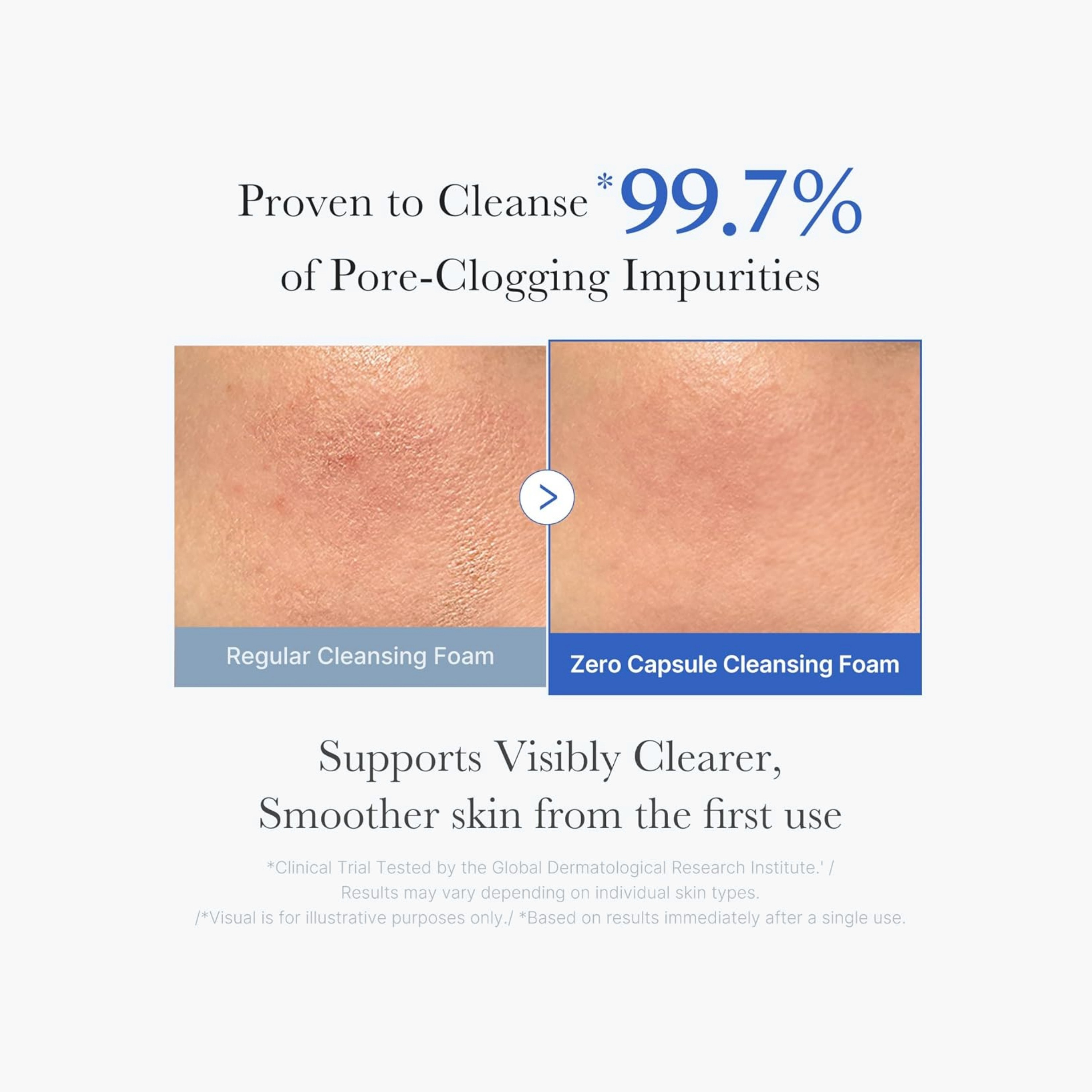 MEDICUBE Clear Capsule Cleansing Foam-beautyandpersonalcare-skin-cleansers-facewashandcleansers-image-5