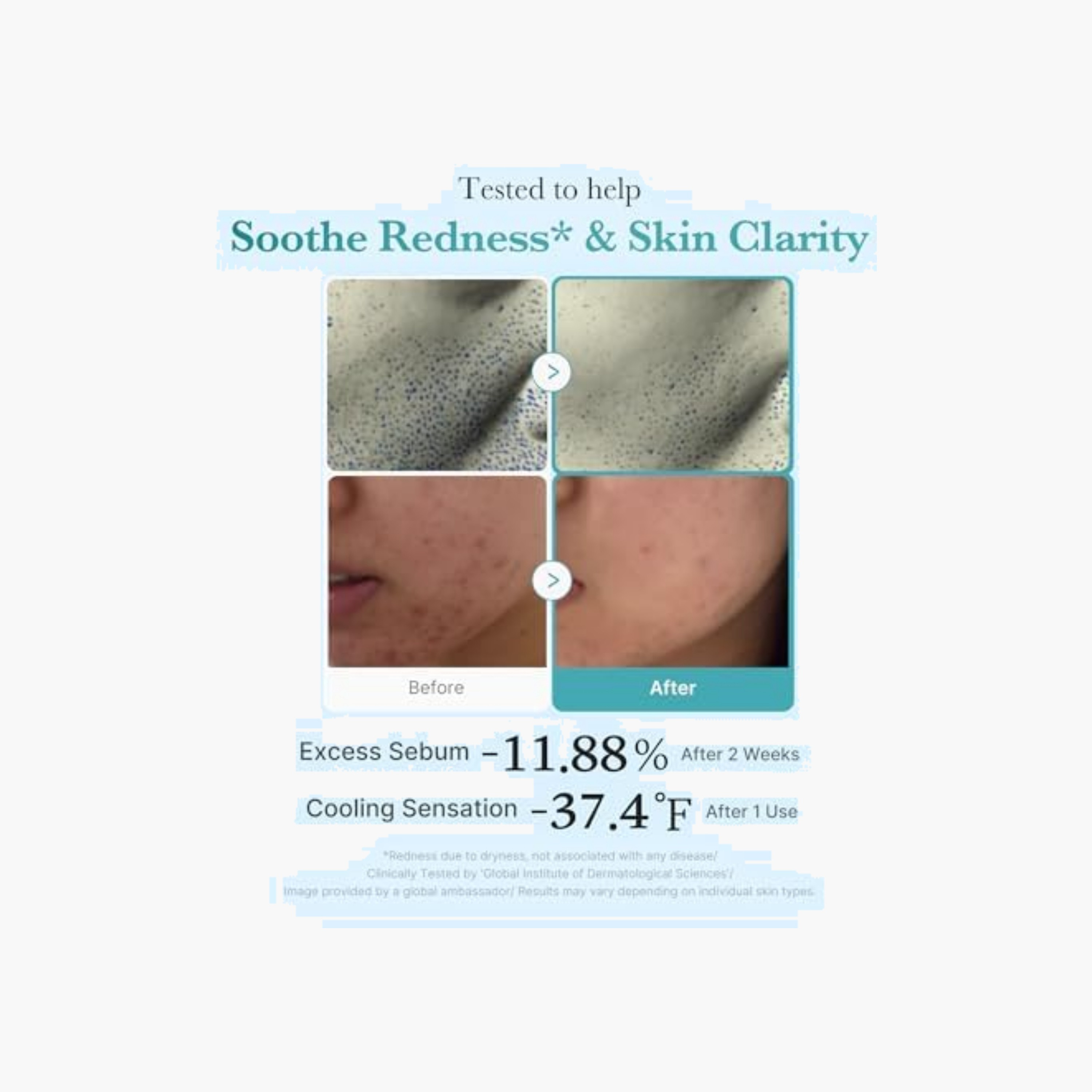 تونر وجه أزيليك نياسيناميد شفاف-beautyandpersonalcare-skin-cleansers-tonerandmists-image-6