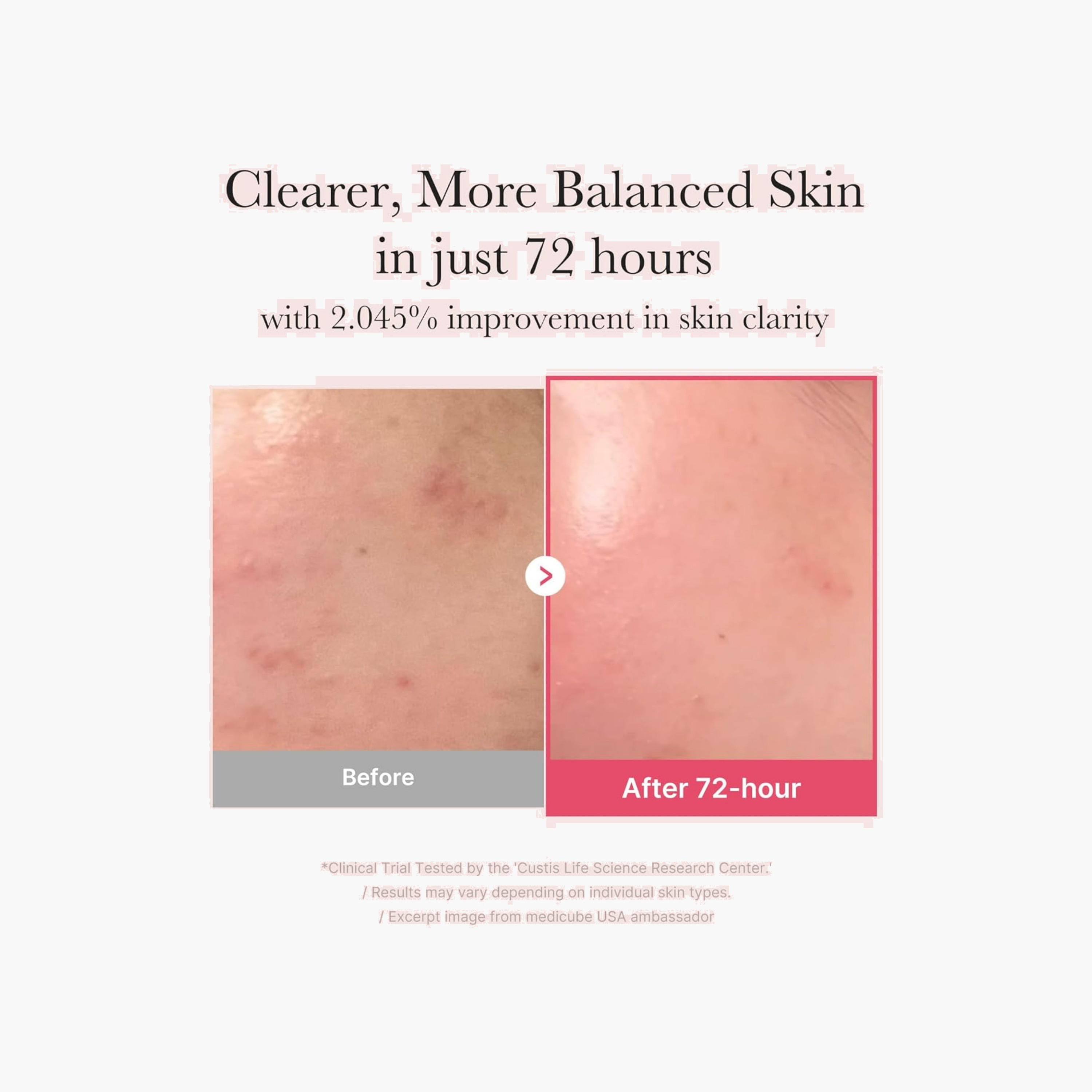 MEDICUBE TXA Niacinamide 15 Serum 30ml-beautyandpersonalcare-skin-treatmentsandserums-image-7