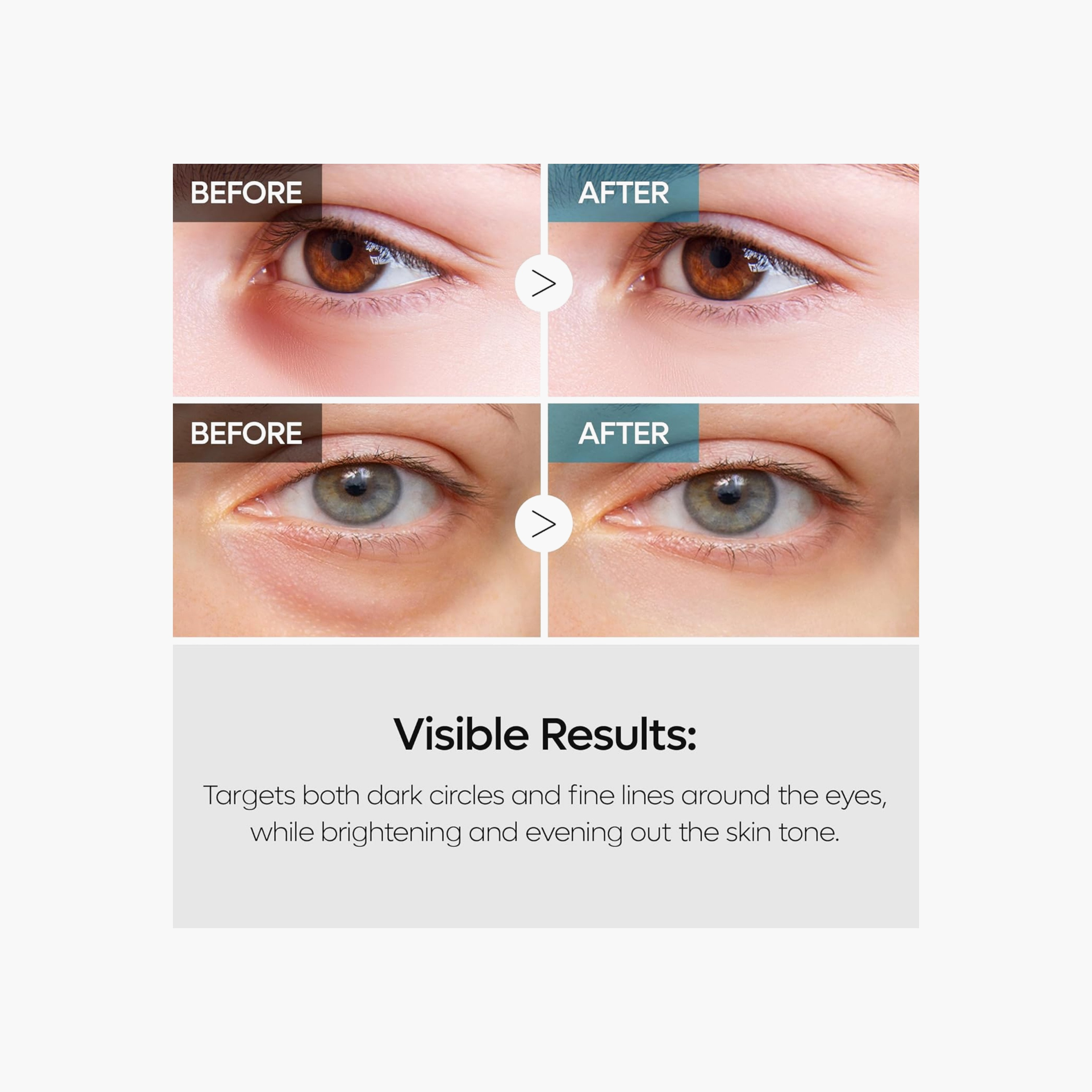 DR.MELAXIN Retinal Double Effect Eye Cream 40g-beautyandpersonalcare-kbeauty-skin-eyecare-image-5