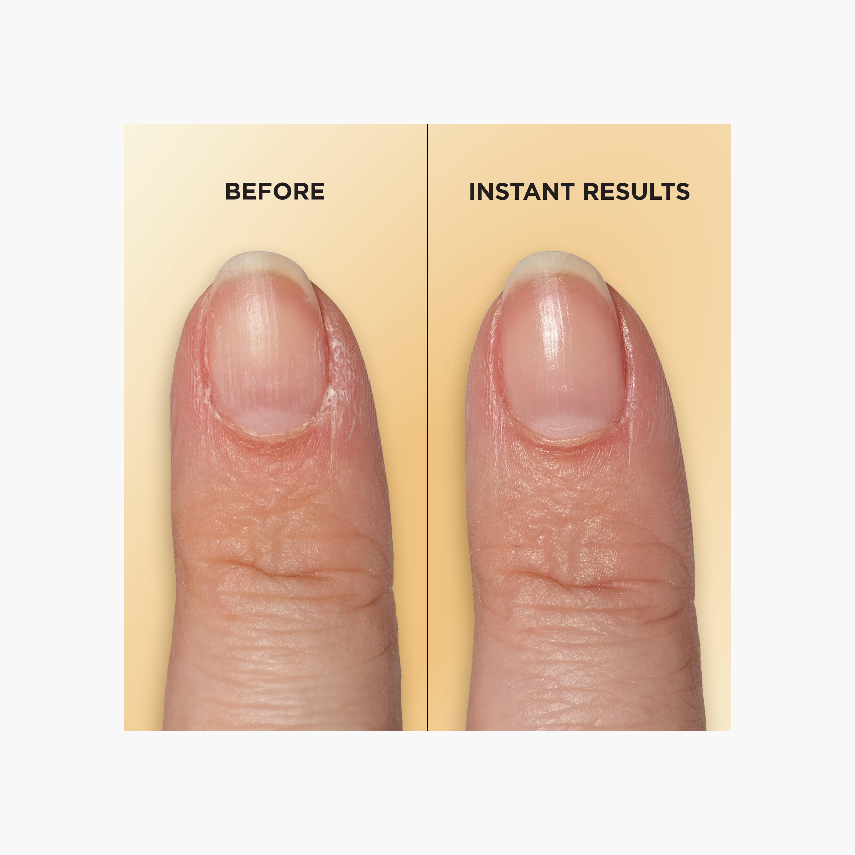 Sally Hansen Vitamin E Nail Cuticle Pen-beautyandpersonalcare-makeup-nails-nailpolishes-image-6