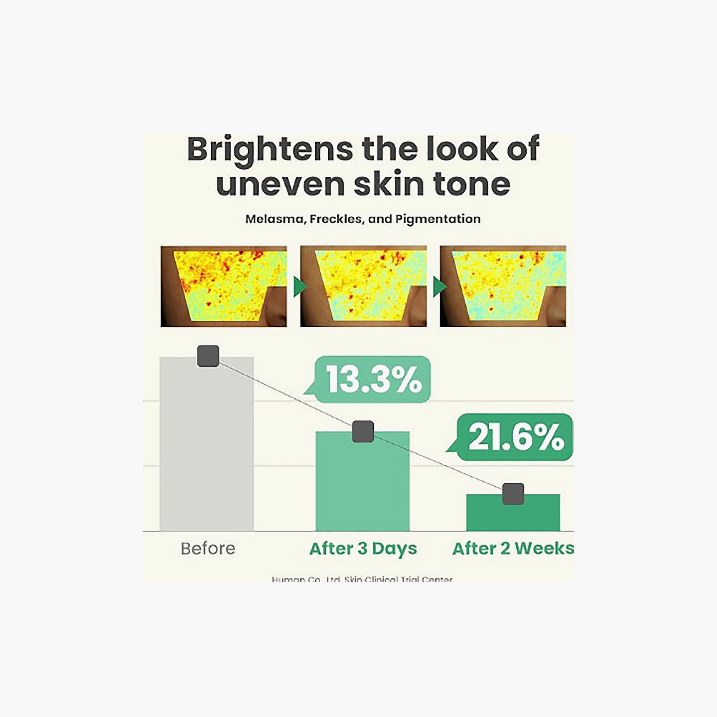 مجموعة هدايا "ذا ميني جلو" من أكسيس واي، 4 × 5 مل-beautyandpersonalcare-kbeauty-skin-treatmentsandserums-image-10