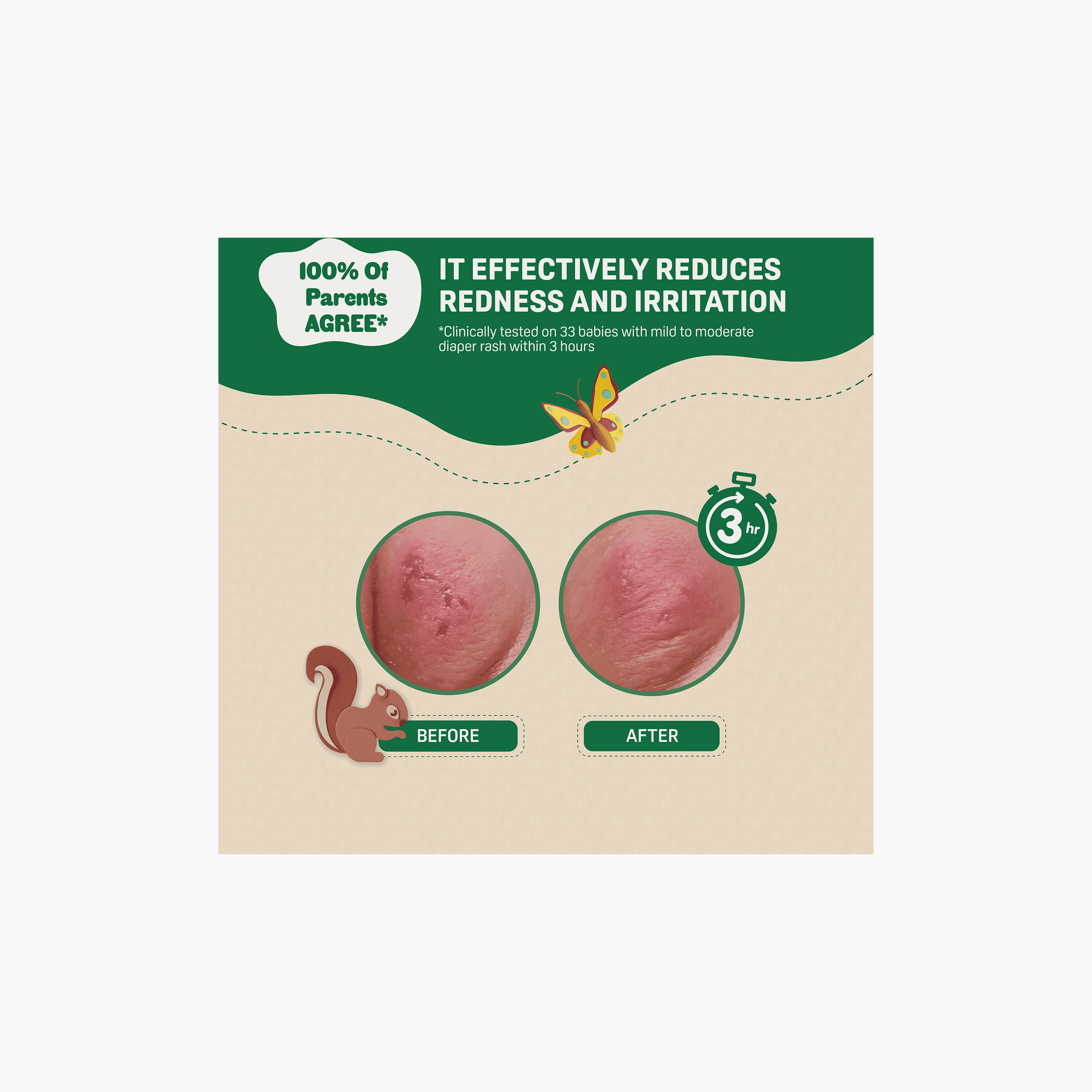 Pigeon Baby Rash Cream with Natural Ingredients-baby-diapering-rashcreams-image-4