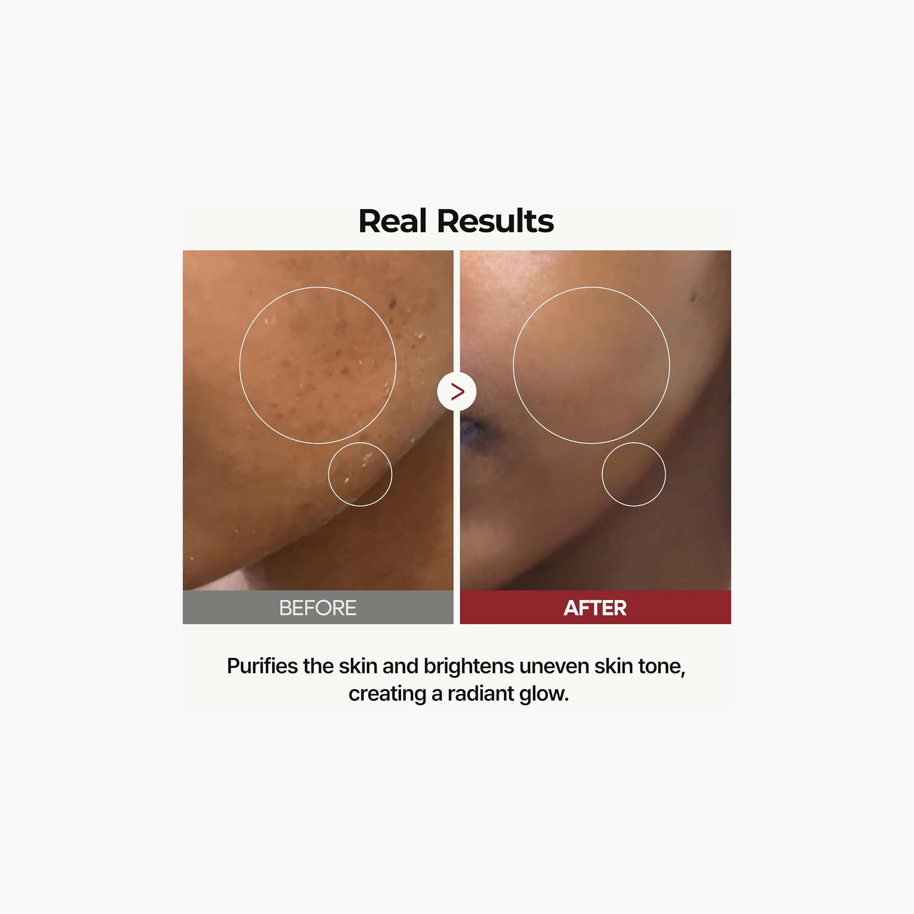 Dr.Melaxin Peel Shot Glow White Rice Toner 200Ml-beautyandpersonalcare-skin-cleansers-tonerandmists-image-3