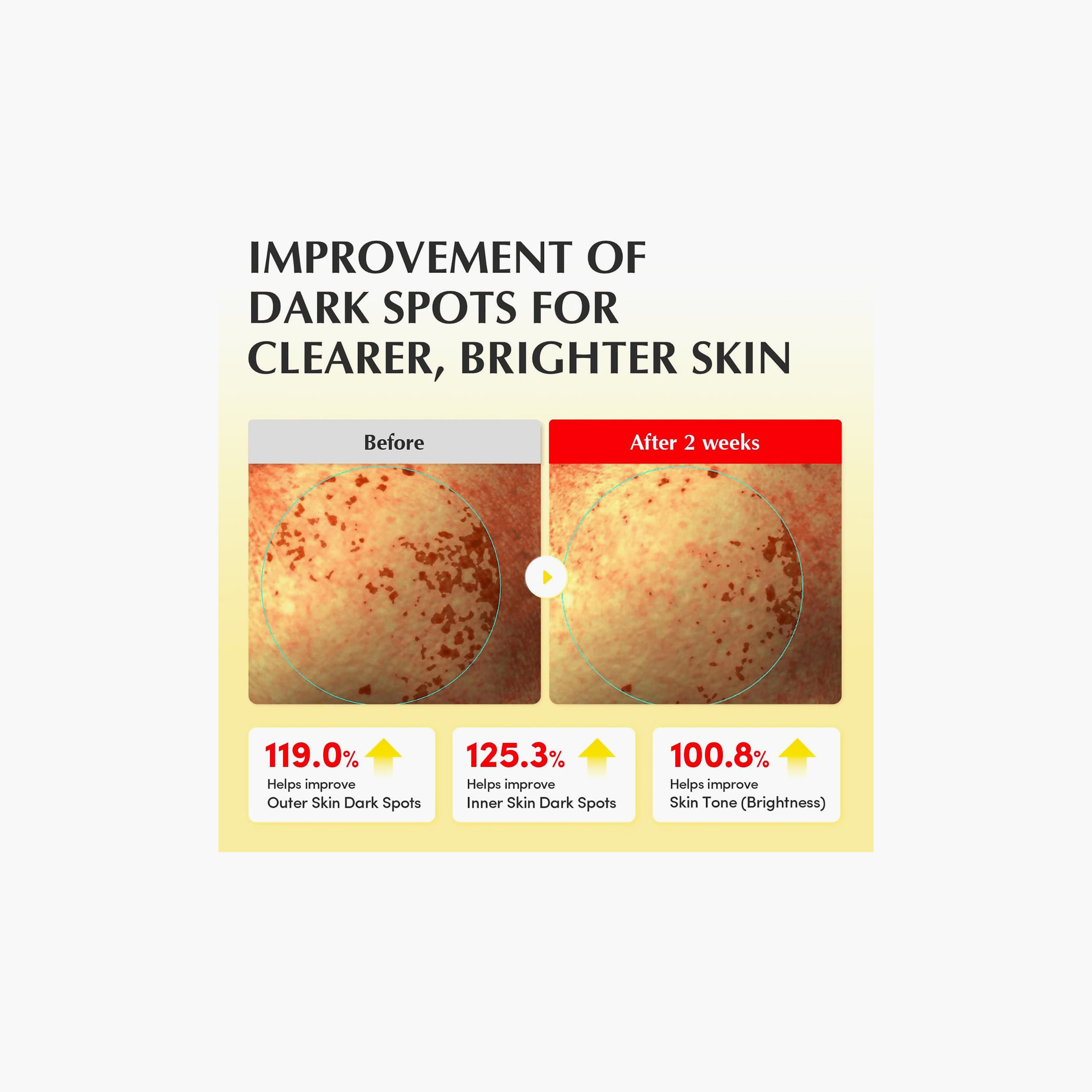 Eqqualberry Glow Filter Vitamin Illuminating Toner 150Ml-beautyandpersonalcare-skin-cleansers-tonerandmists-image-4