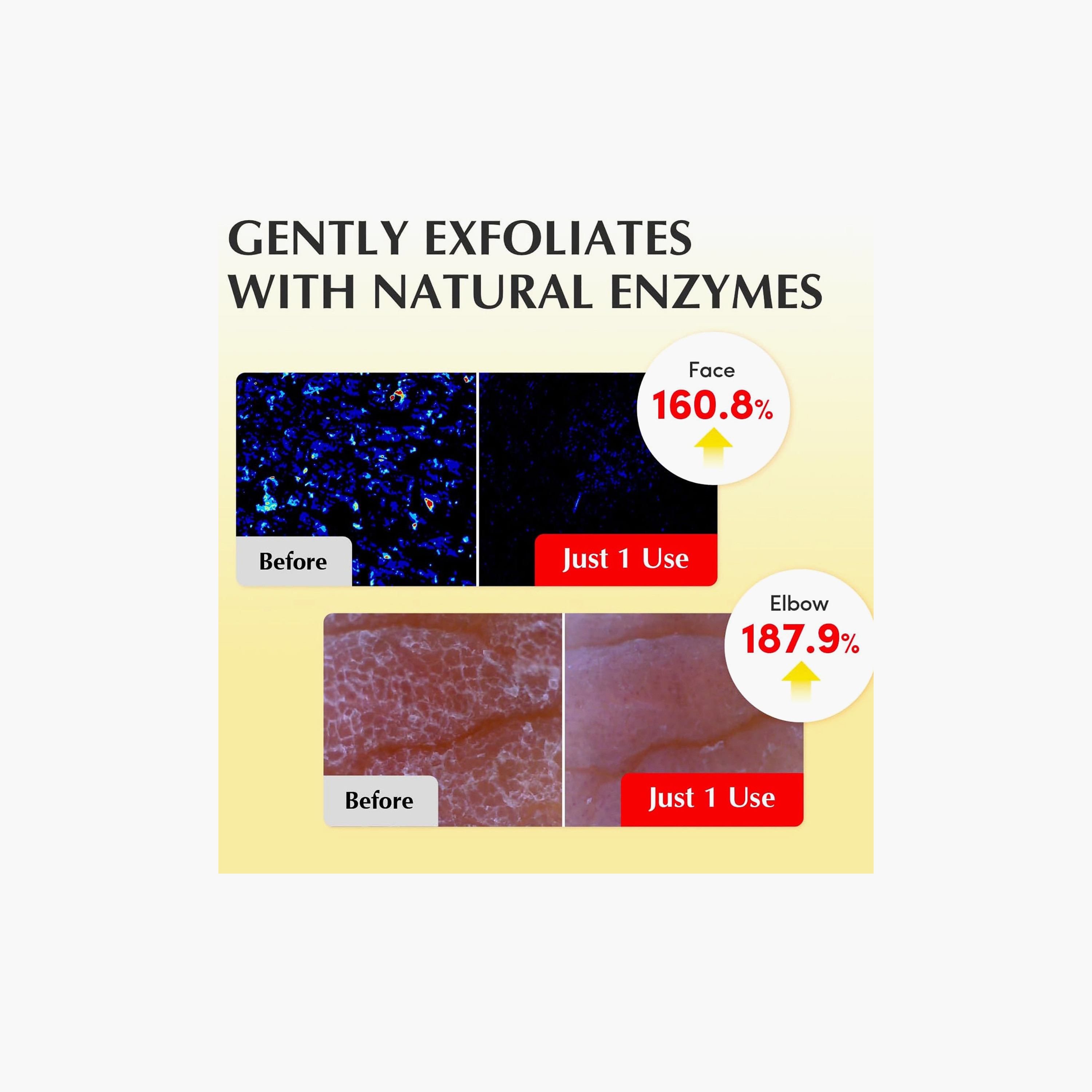 Eqqualberry Glow Filter Vitamin Illuminating Toner 150Ml-beautyandpersonalcare-skin-cleansers-tonerandmists-image-5