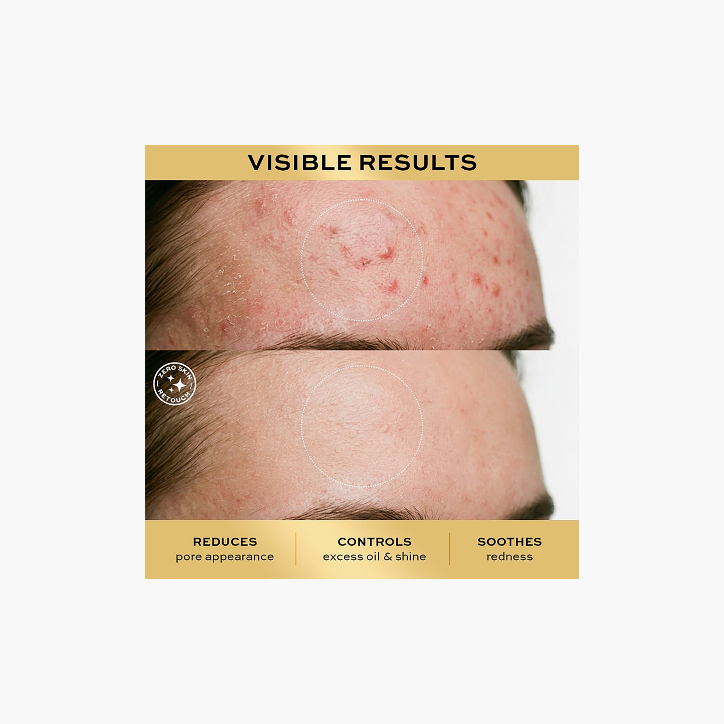 سيروم ريفوليوشن برو ميراكل المنقي 10% نياسين 1% زنك 30 مل-beautyandpersonalcare-skin-treatmentsandserums-image-7