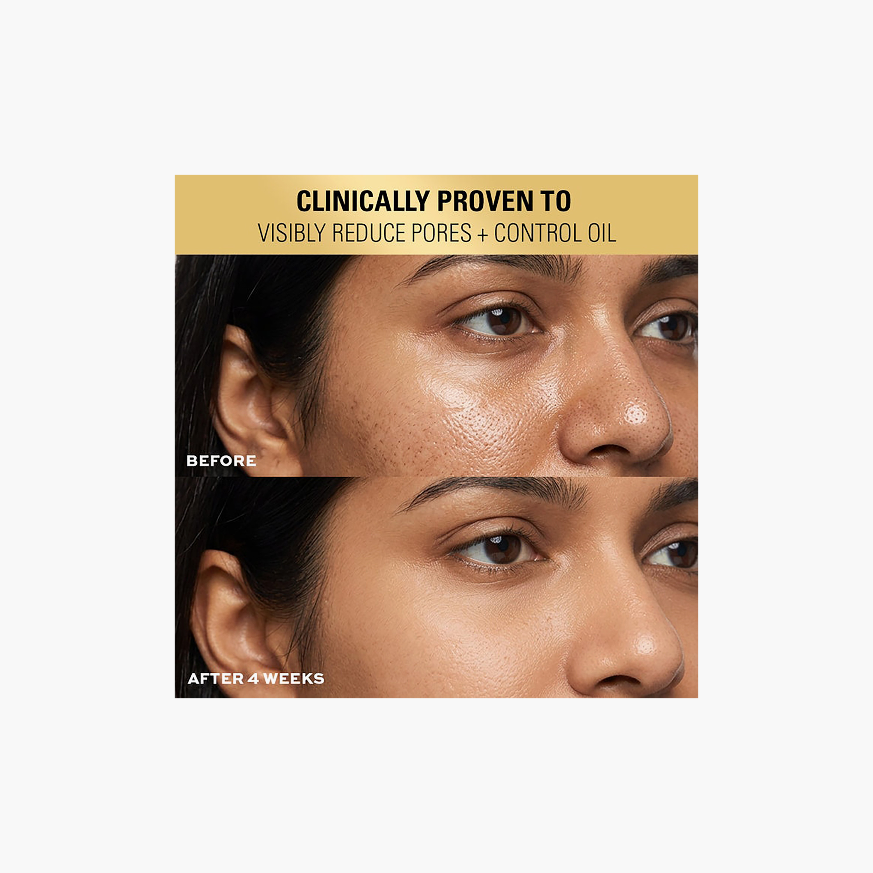 ريفوليوشن برو ميراكل 2% حمض الساليسيليك BHA لتنقية البشرة 30 مل-beautyandpersonalcare-skin-treatmentsandserums-image-7