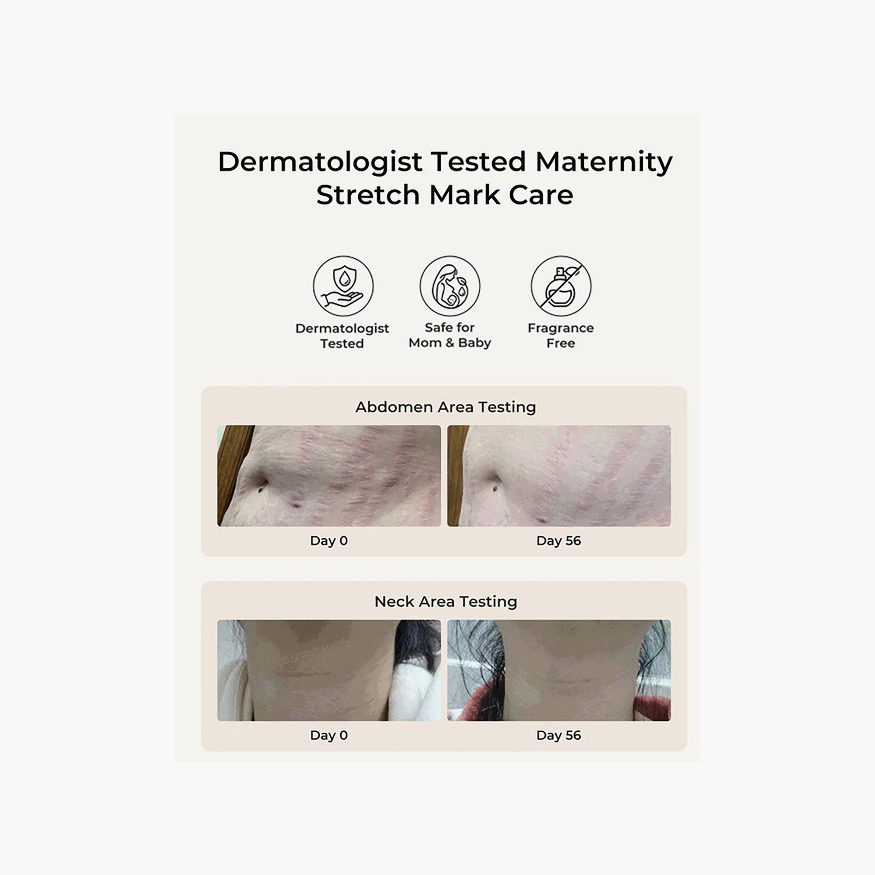 مرطب "بريكولاجين" لشد وترطيب البطن من مومكوزي - 150 جم-baby-bathandcare-hairbodyskincare-lotionsandcreams-image-14