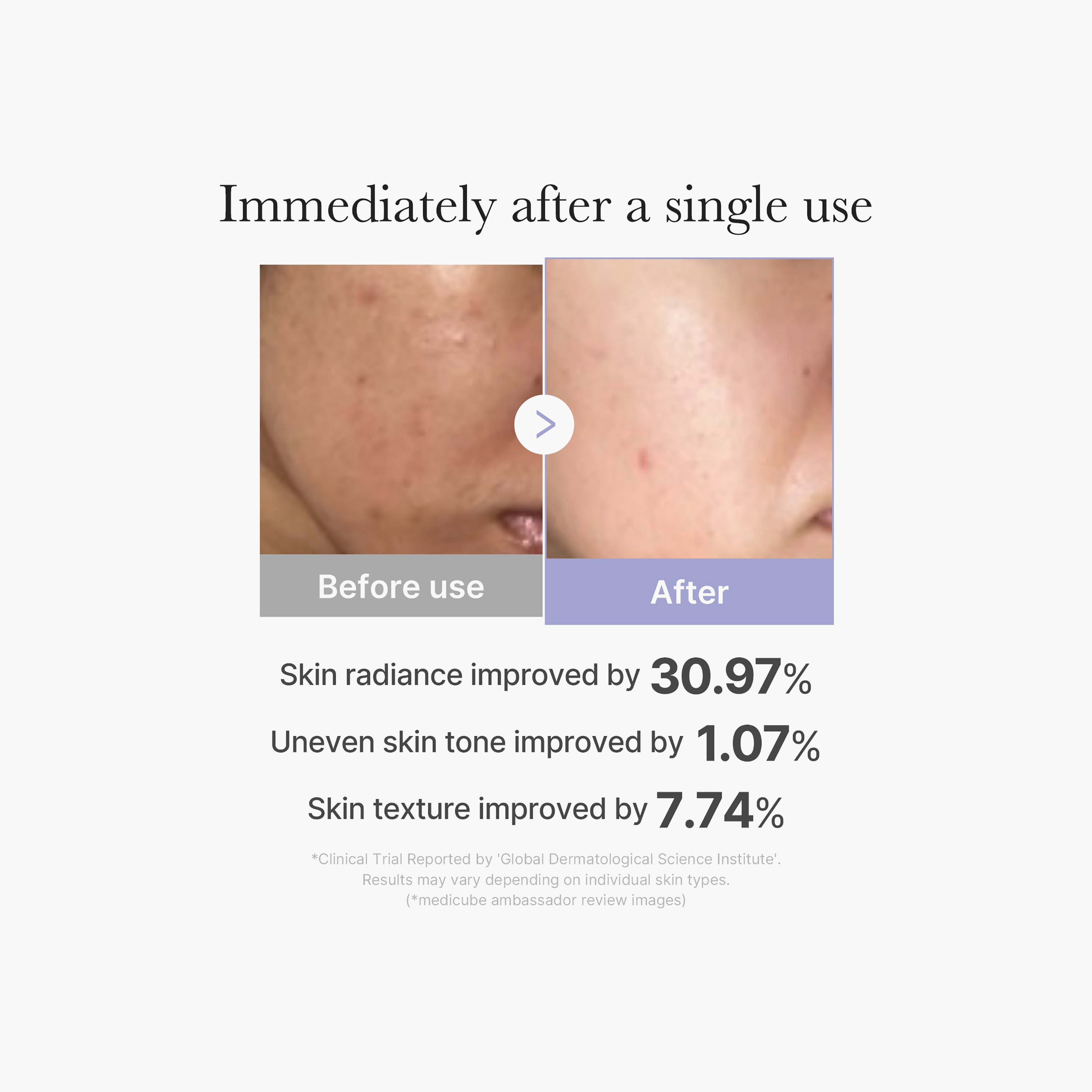 جهاز ميديكوب إيج-آر بوستر برو ميني بلس الوردي للوجه-beautyandpersonalcare-kbeauty-skin-moisturisers-facemoisturisers-image-4