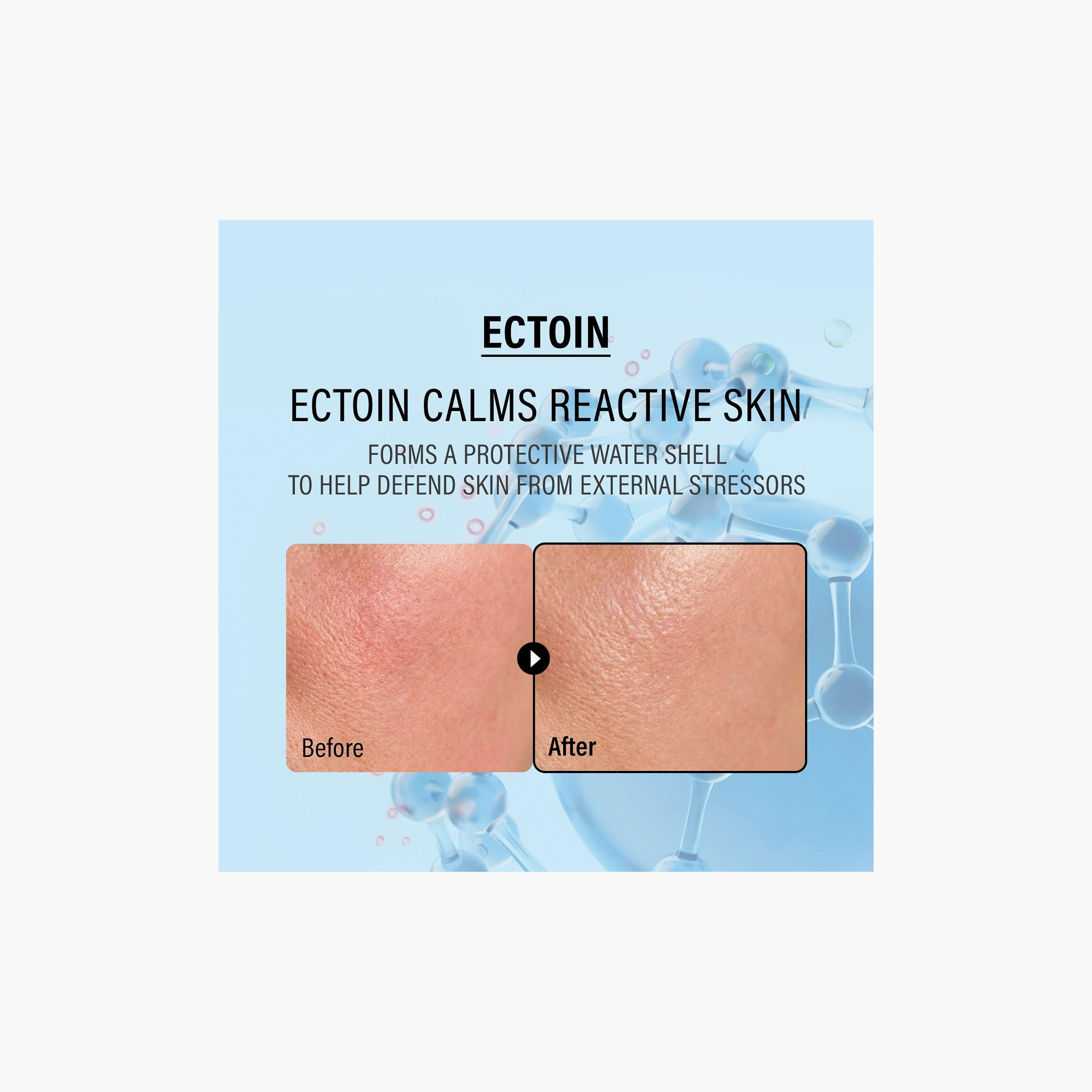 Epii Ectoin & Panthenol Soothing Barrier Cream 50Ml-beautyandpersonalcare-kbeauty-skin-moisturisers-facemoisturisers-image-9