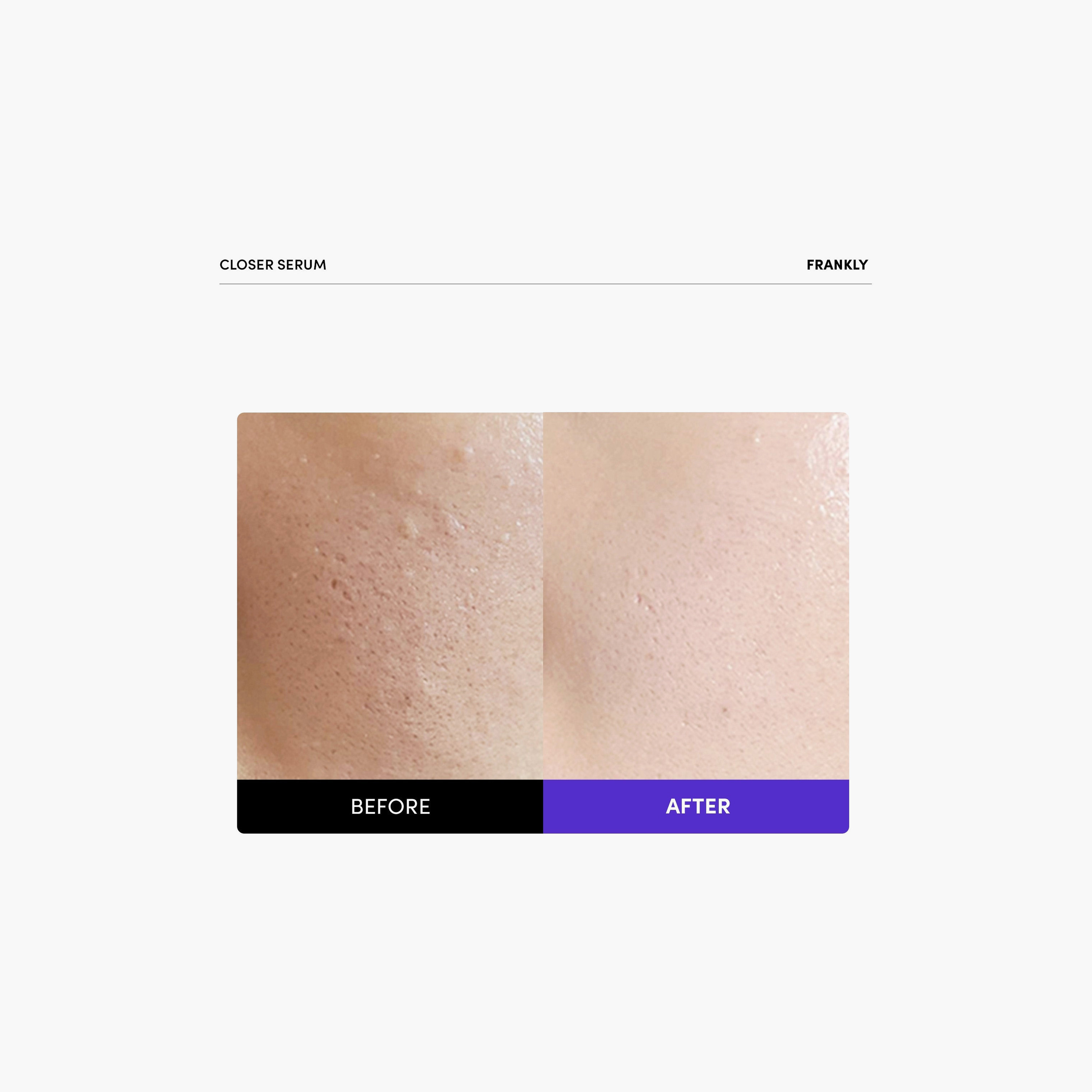 سيروم فرانكلي كلوزر 60 مل-beautyandpersonalcare-kbeauty-skin-moisturisers-facemoisturisers-image-5